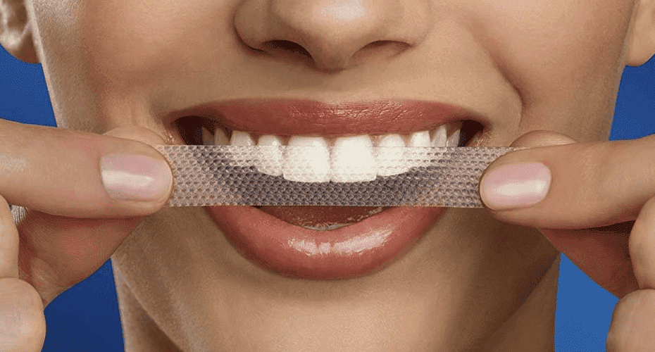 10 лучших отбеливающих полосок для зубов - рейтинг 2020